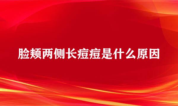 脸颊两侧长痘痘是什么原因